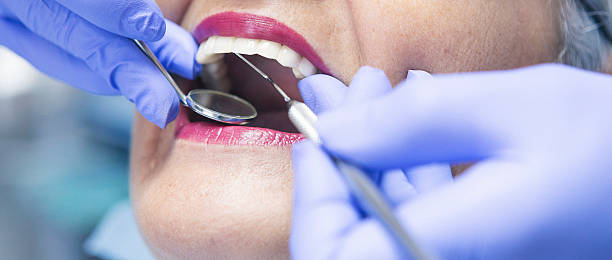 Best Emergency Dental Care for Abscessed Tooth in Biltmore Forest, NC