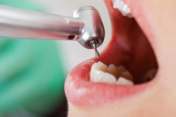 Best Emergency Dentist for Special Needs Patients in Biltmore Forest, NC